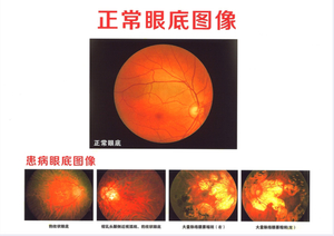 Porcelain white laser film