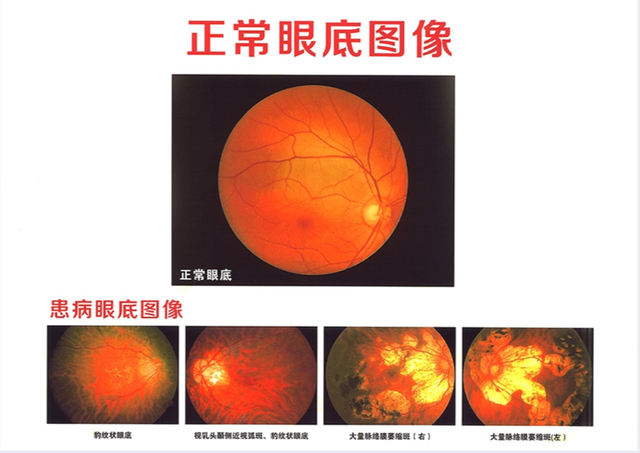 Porcelain white laser film