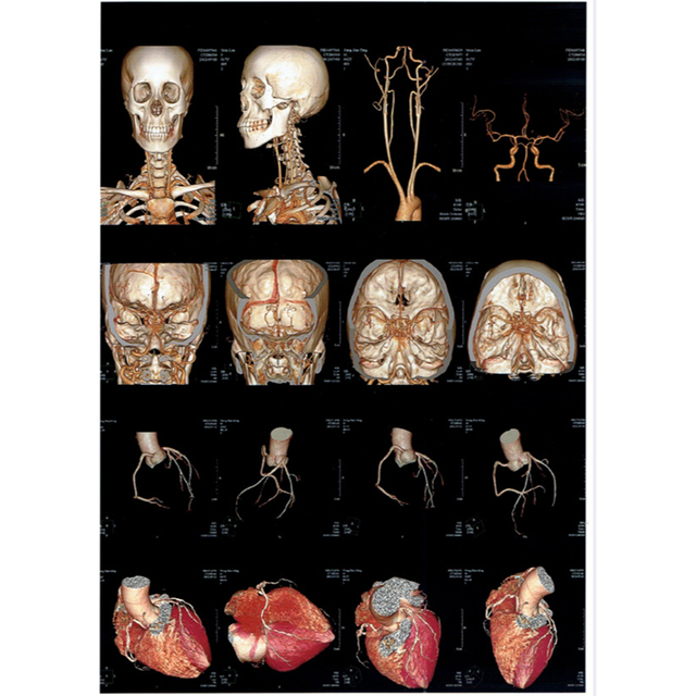 Porcelain White Inkjet Film
