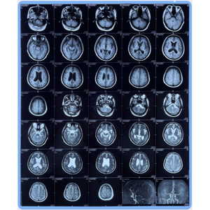 Thermal Nuclear Magnetic Sheet